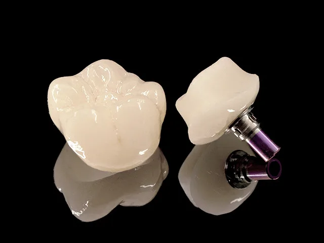 Individuelles Abutment